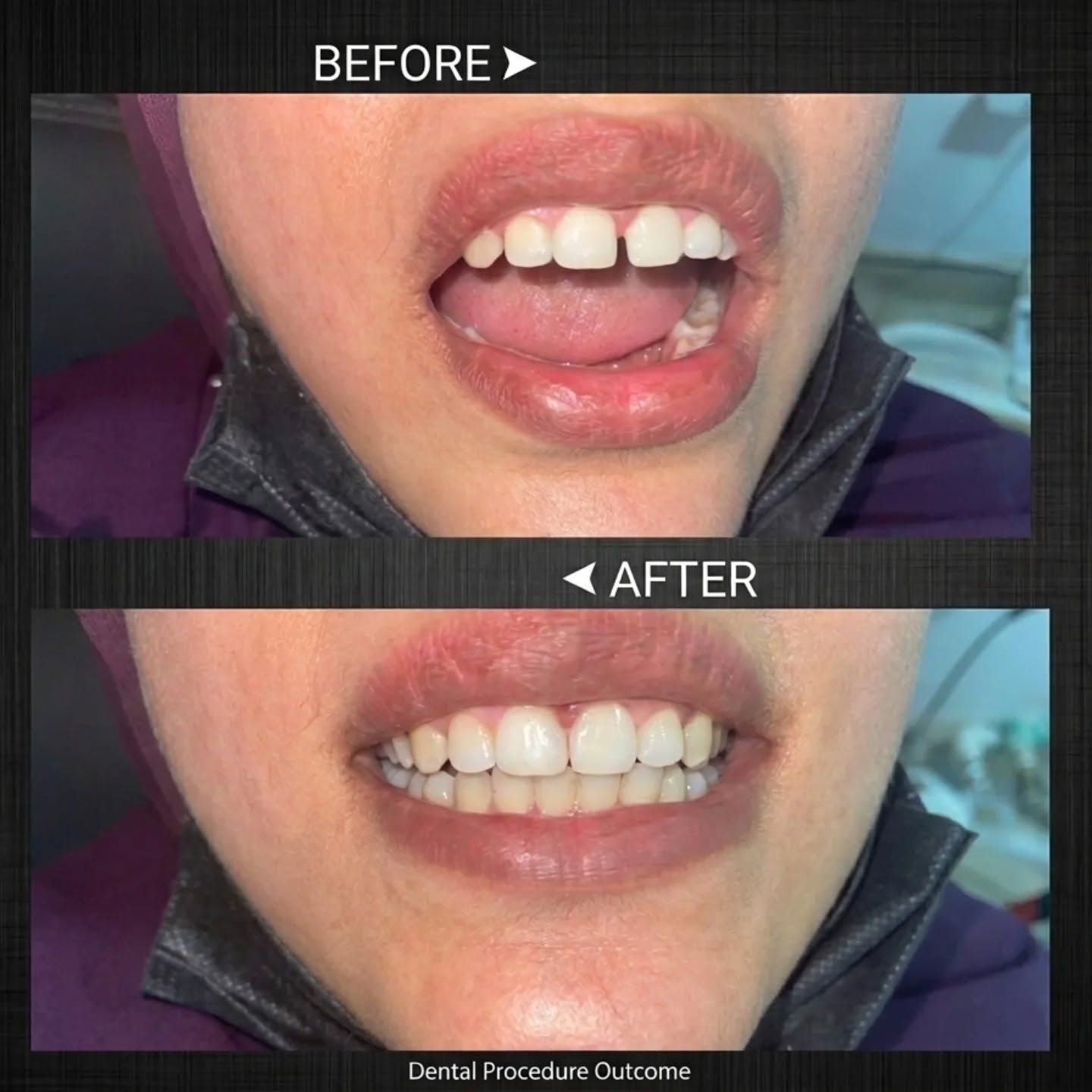 Esthetic therapy progress